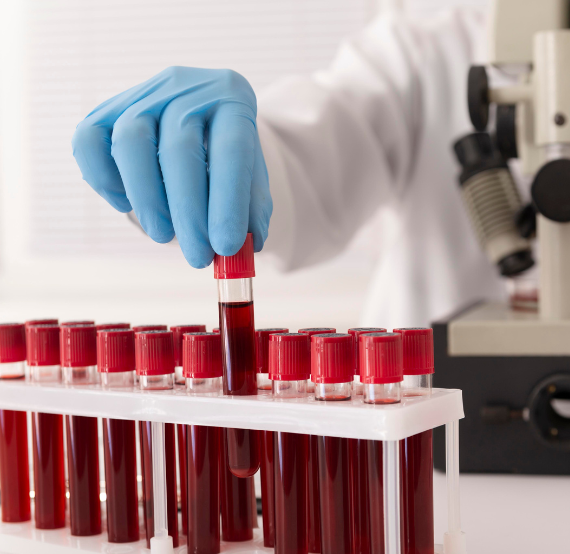 best diagnostic & Pathology centre delhi